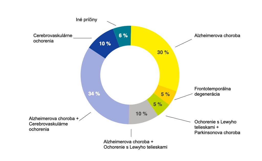 Najčastejšie príčiny demencie